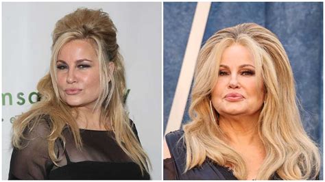 Jennifer Coolidges plastic surgery and stunning transformation